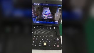 Przenośna maszyna do kolorowego dopplera 4D BR-US15 (V3.0)