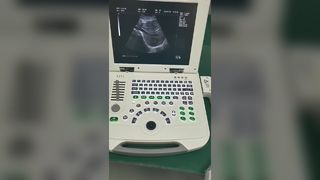 W pełni cyfrowy laptopowy system diagnostyki ultradźwiękowej 80element BR-US11