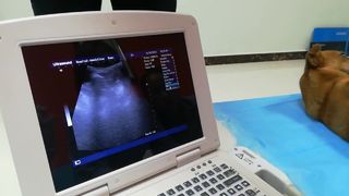 W pełni cyfrowy laptopowy system diagnostyki USG 96 elementów BR-US10