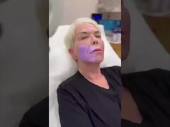 Urządzenie do wyszukiwania żył QV 600 do dokładnego nakłucia żyły