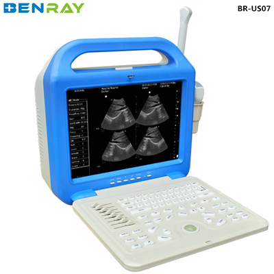 Digital Laptop Ultrasonic  Diagnosis  Equipment to Human