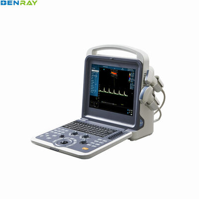 Przenośny ultradźwiękowy system diagnostyczny Color Doppler 80 elementów