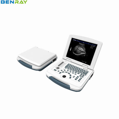 W pełni cyfrowy laptopowy system diagnostyki USG 96 elementów