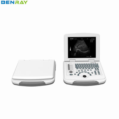 W pełni cyfrowy laptopowy system diagnostyki USG 80element